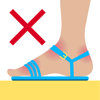 correct toe sandal